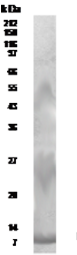 RELM beta antibody