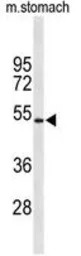 Kir6.2 antibody, N-term