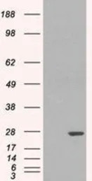 GSTP1 antibody, Internal
