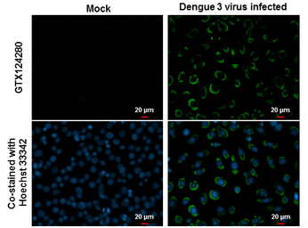 Dengue virus NS1 protein antib
