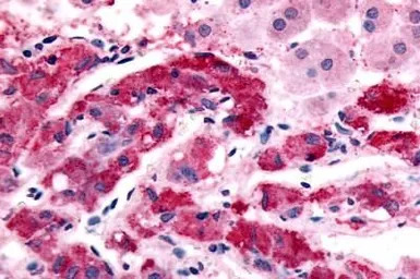 alpha 1b Adrenergic Receptor a