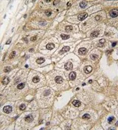 PERK antibody, N-term