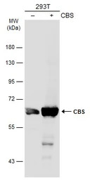 CBS antibody