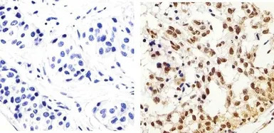 IRS1 (phospho Tyr896) antibody