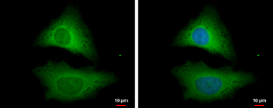 STRAP antibody [N1C3]