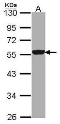 DDX6 antibody