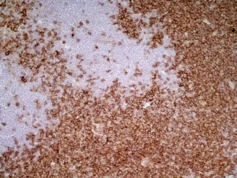 CD4 antibody [W3/25]