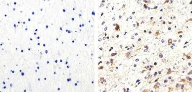 Tau (phospho Ser214) antibody