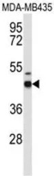 GABA A Receptor delta antibody