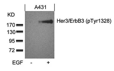 Her3 / ErbB3 (phospho Tyr1328)