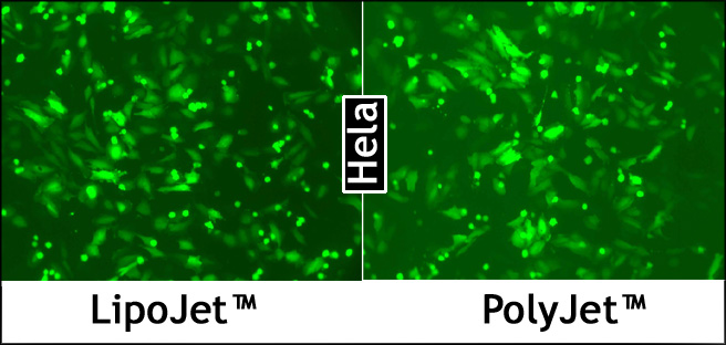 LipoJet™体外DNA转染试剂盒