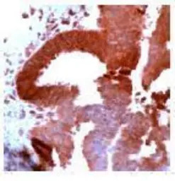 PDGF Receptor alpha antibody (