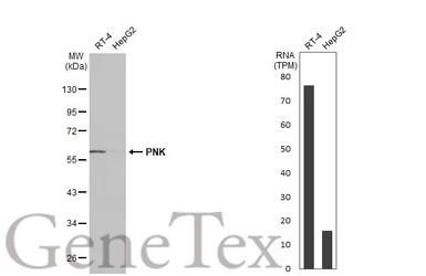 PNK antibody [N1C1]