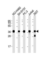 EN1 antibody, N-term