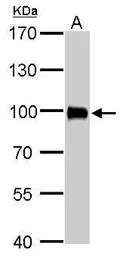 Villin antibody