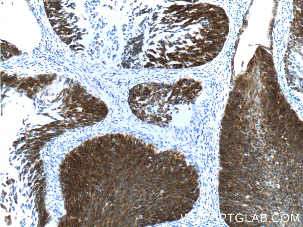 细胞角蛋白16抗体，Cytokeratin 16 Antib