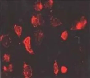 beta 1 Adrenergic Receptor ant