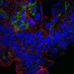 PTP4A3 antibody [N1C3]