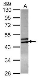 ZNF439 antibody [N2C1], Intern