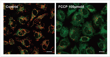 1606294523249551.png 1606294523249551.png