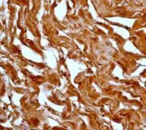 MEK6 antibody [EP558Y], C-term