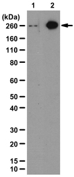 Acetyl-CoA Carboxylase 1 (phos