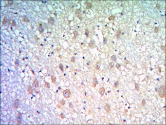 KLHL21 antibody [2H4]