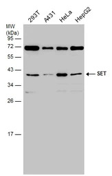 SET antibody, isoform 2-specif
