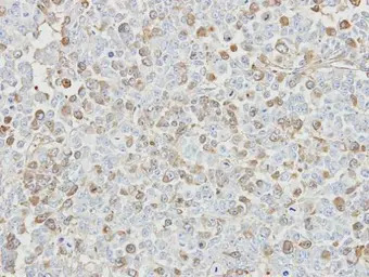 USP5 antibody [C1C3]