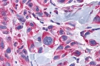 alpha 1d Adrenergic Receptor a