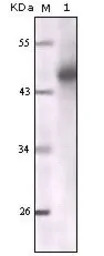 pan Cytokeratin antibody [7H8C