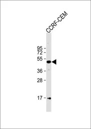 n-Myc antibody, C-term
