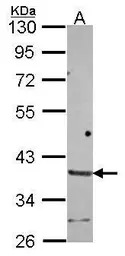 HAPLN2 antibody [N1C1]