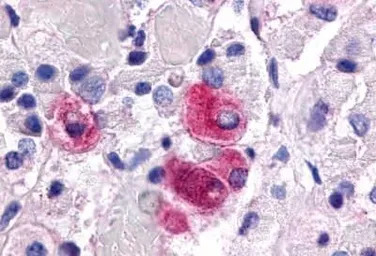 Steroidogenic Factor 1 antibod