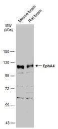 EphA4 antibody [N3C2], Interna