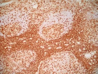 CD4 antibody [RPA-T4] (Low end