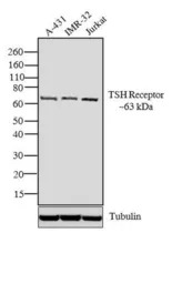 TSH receptor antibody [49]