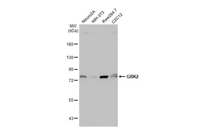 GRK2 antibody [C2C3], C-term