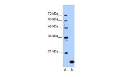 NAT13 antibody, C-term