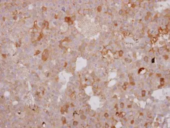 beta 1 Adrenergic Receptor ant