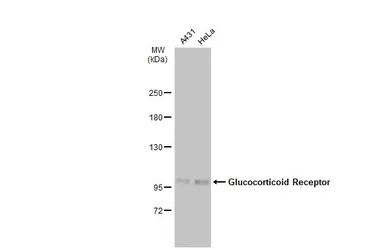 Glucocorticoid Receptor antibo