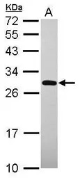 UNKL antibody [N1N2], N-term
