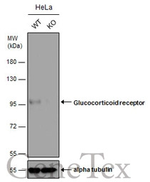 Glucocorticoid Receptor antibo