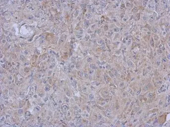 MRPL10 antibody [N1C2]