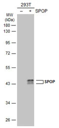 SPOP antibody [N1C1]
