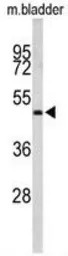 ACTR3B antibody, C-term
