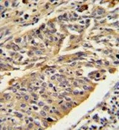 Cathepsin E antibody, Internal