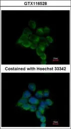ILKAP antibody [N2C3]