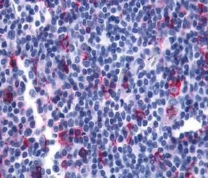 Leukotriene B4 Receptor 2 anti