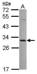 MAGEA4 antibody